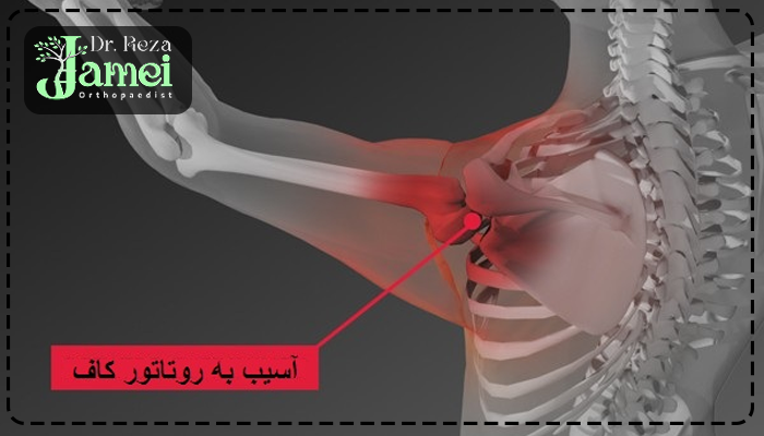 روتاتور کاف شانه